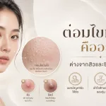 ภาพประกอบบทความ ต่อมไขมันโต คืออะไร ต่างจากสิวและซีสต์อย่างไร - About Skin Clinic