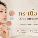 ภาพประกอบบทความ กระเนื้อ คืออะไร เกิดจากอะไร ต่างจากกระแดดอย่างไร - About Skin Clinic