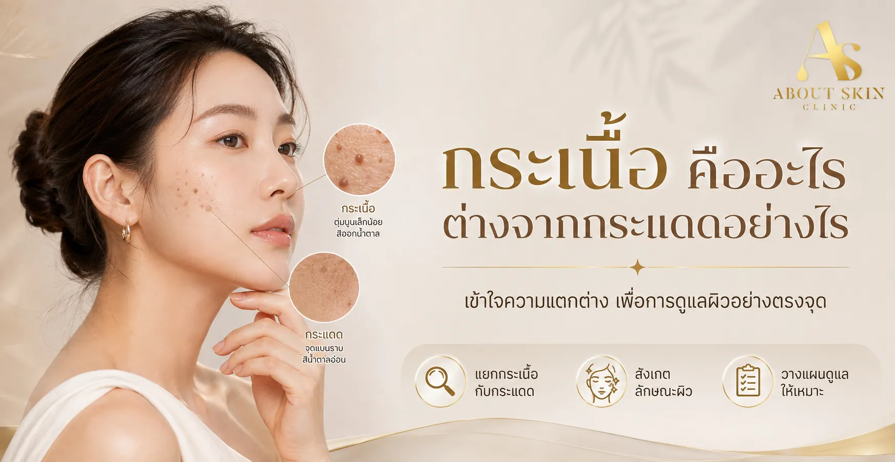 ภาพประกอบบทความ กระเนื้อ คืออะไร เกิดจากอะไร ต่างจากกระแดดอย่างไร - About Skin Clinic