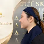 โปรแกรม Skinvive — เคสจริง About Skin Clinic