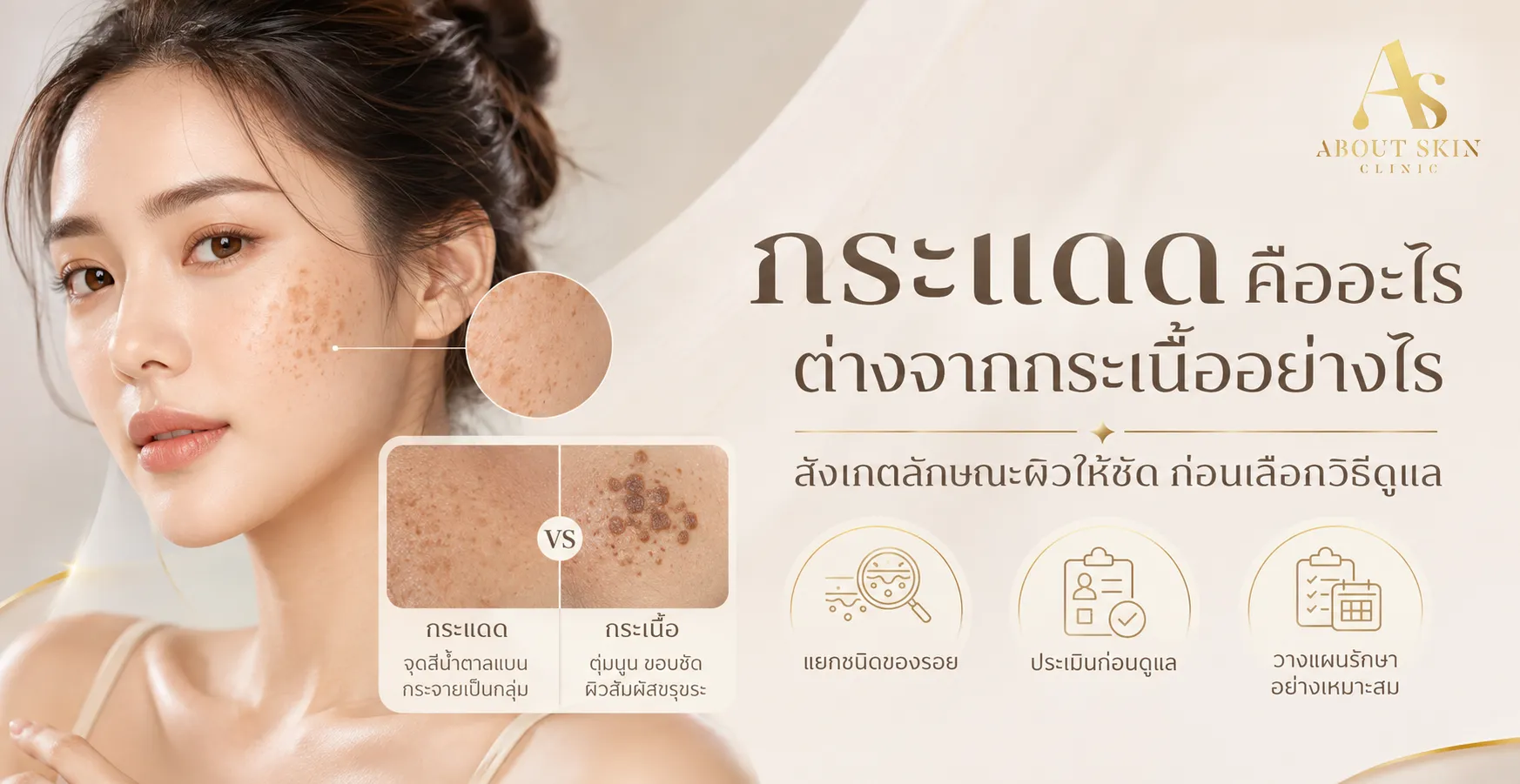 ภาพประกอบบทความ กระแดด คืออะไร ต่างจากกระเนื้ออย่างไร - About Skin Clinic