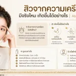 ภาพประกอบบทความ สิวจากความเครียด มีจริงไหม เกิดขึ้นได้อย่างไร - About Skin Clinic