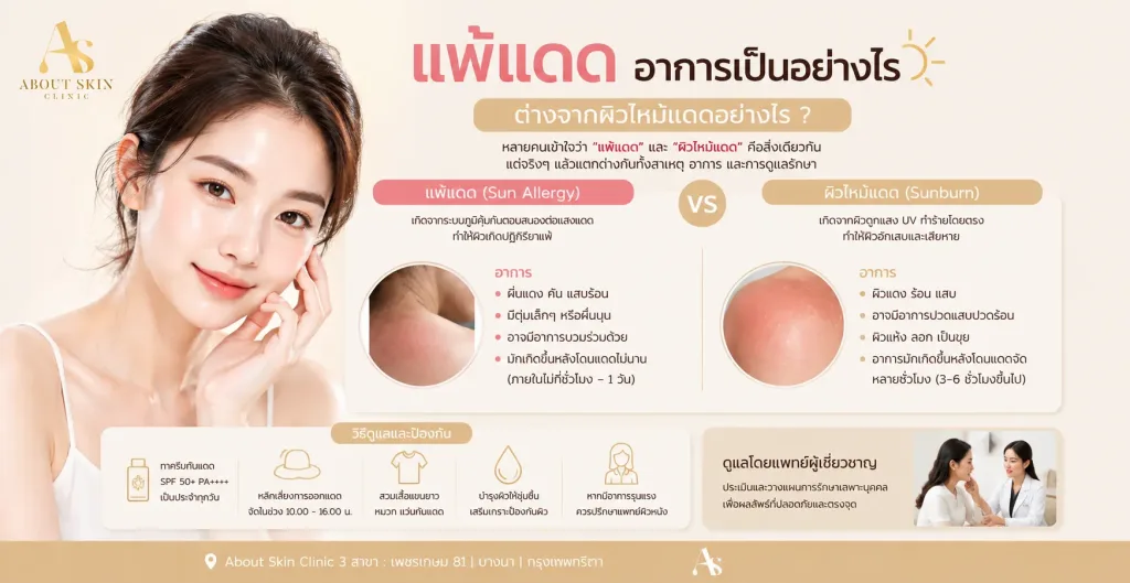 ภาพประกอบบทความ แพ้แดด อาการเป็นอย่างไร ต่างจากผิวไหม้แดดอย่างไร - About Skin Clinic