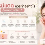 ภาพประกอบบทความ ผิวไหม้แดด ควรทำอย่างไร ทิ้งรอยดำได้ไหม - About Skin Clinic