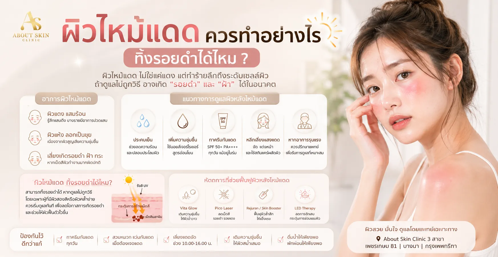 ภาพประกอบบทความ ผิวไหม้แดด ควรทำอย่างไร ทิ้งรอยดำได้ไหม - About Skin Clinic