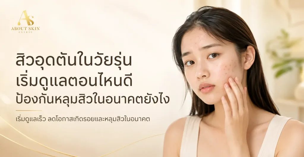 ภาพประกอบบทความ สิวอุดตันในวัยรุ่น เริ่มดูแลตอนไหนดี ป้องกันหลุมสิวในอนาคตยังไง - About Skin Clinic
