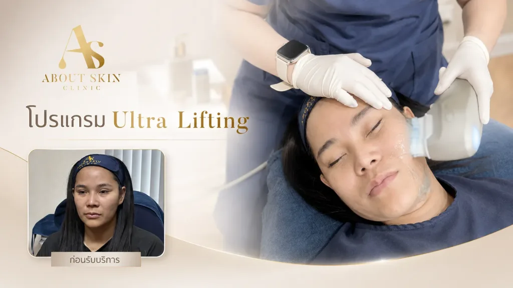 โปรแกรม Ultra Lifting — เคสจริง ทีมแพทย์ About Skin Clinic