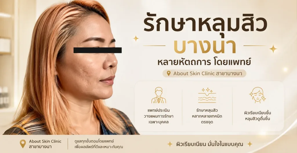 About Skin Clinic หลุมสิว บางนา