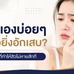ภาพประกอบบทความ กดสิวเองบ่อยๆ ทำไมสิวยิ่งอักเสบ? พฤติกรรมที่ทำให้สิวไม่หายสักที | About Skin Clinic เพชรเกษม - About Skin Clinic