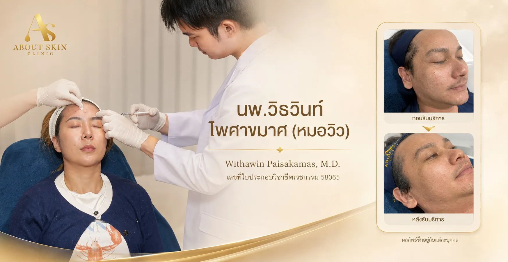 นพ.วิธวินท์ ไพศาขมาศ (หมอวิว) About Skin Clinic - ภาพกิจกรรม 2