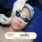 โปรแกรมกดสิว About Skin Clinic