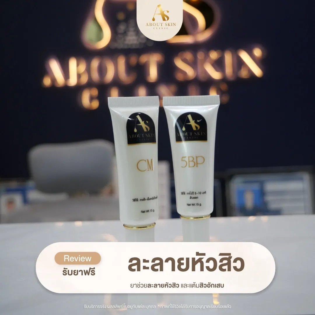 โปรแกรมยาละลายหัวสิว About Skin Clinic