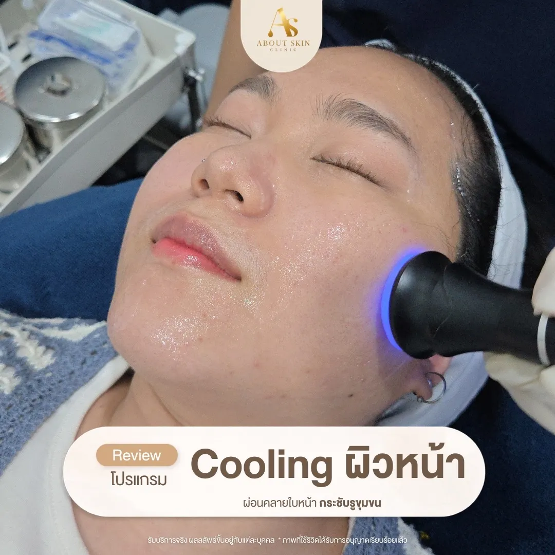 โปรแกรม Cooling ผิวหน้า About Skin Clinic