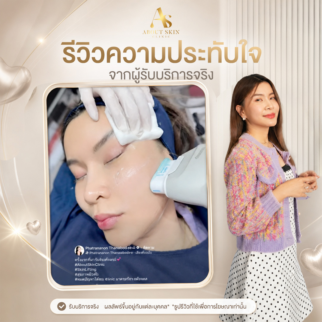 รีวิวโปรแกรม Ultra Lifting About Skin Clinic จากลูกค้าจริง