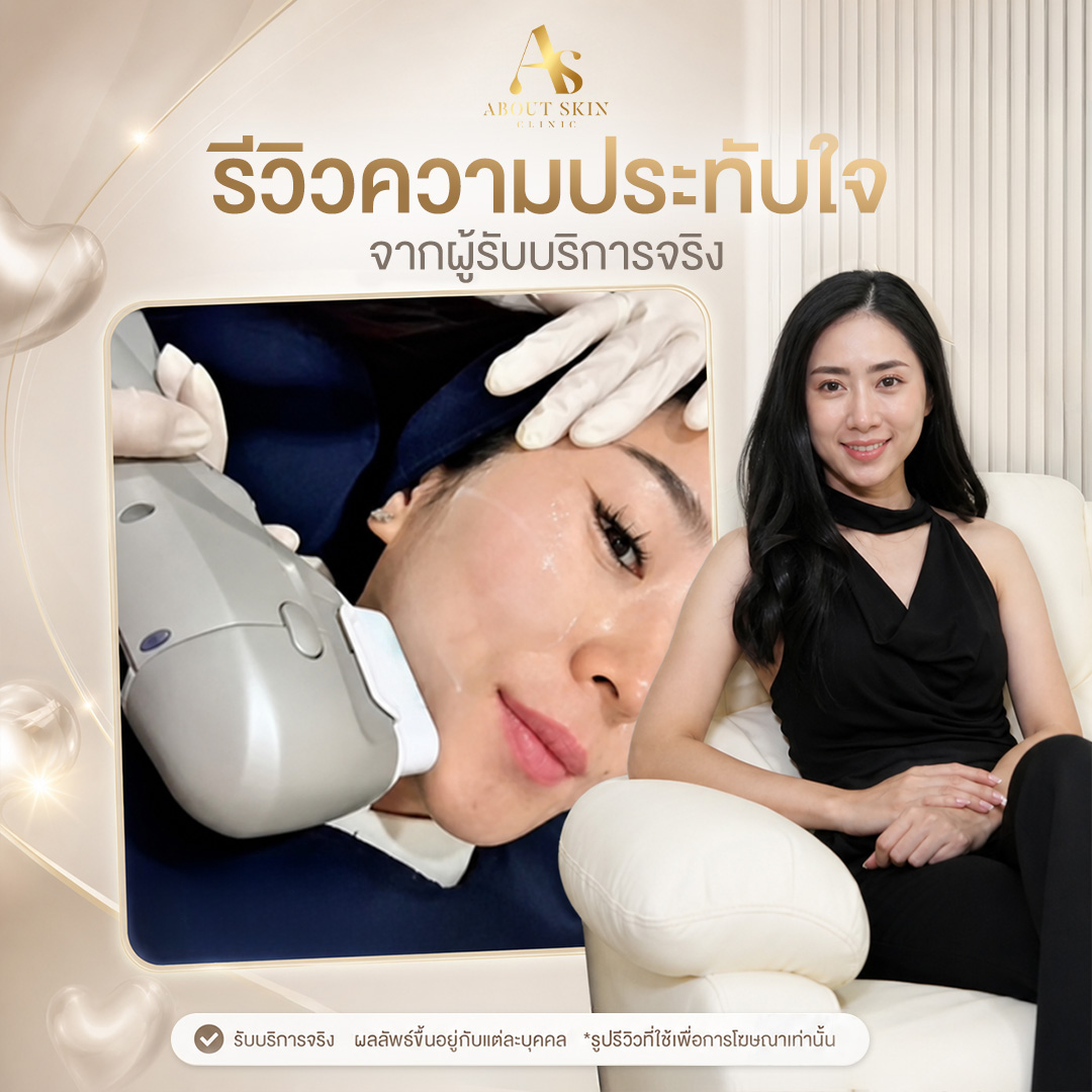 รีวิวโปรแกรม Ultra Lifting About Skin Clinic เคสที่ 2